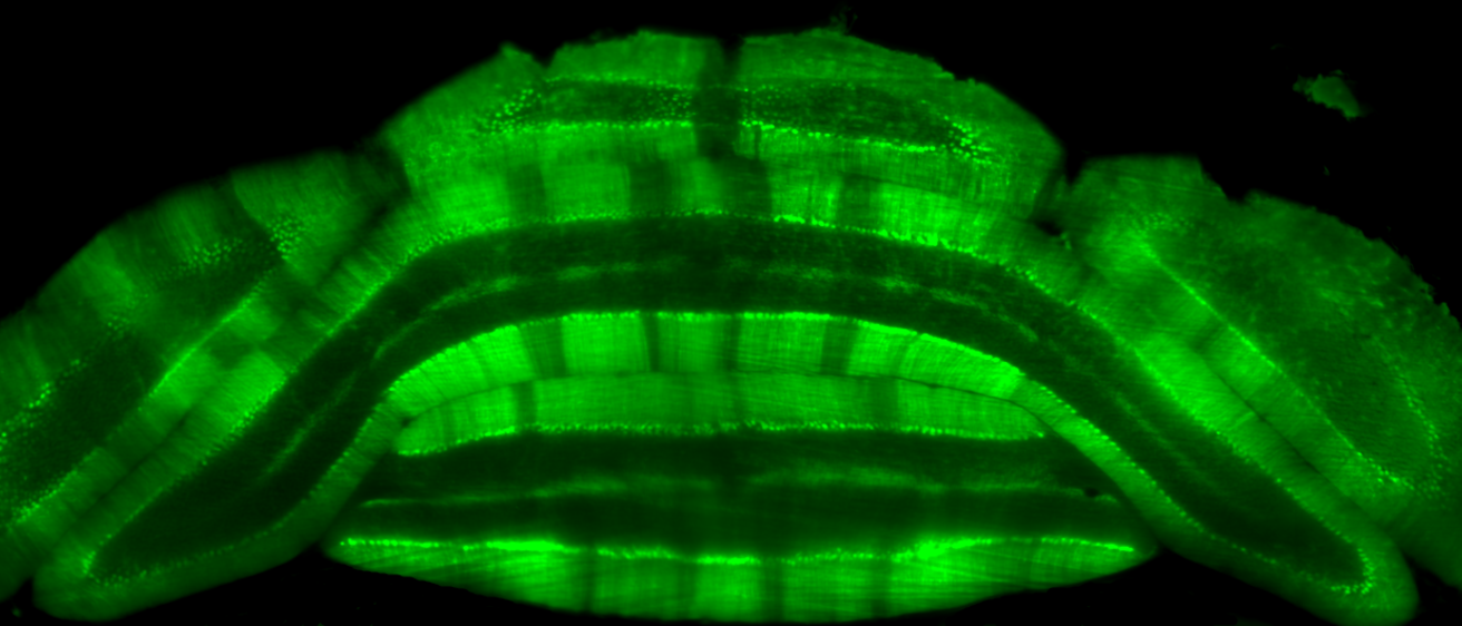 Cerebellum