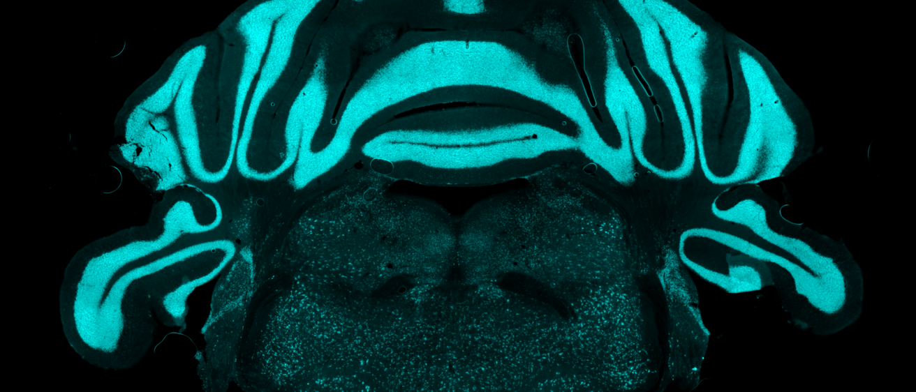 brain