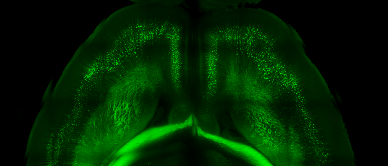 brain